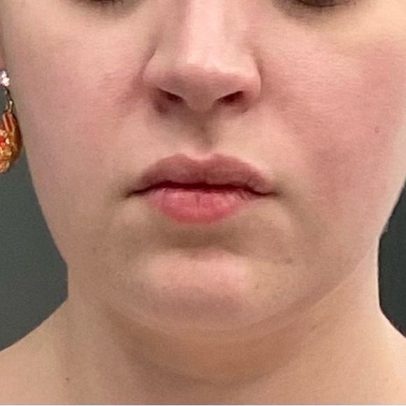 Betsy Johnson flower earrings - Picture 2 of 3